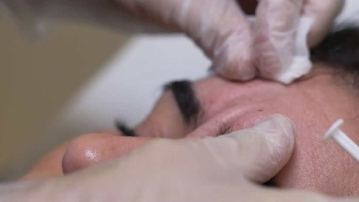 Chirurgie esthétique : la jeunesse à la recherche de la perfection